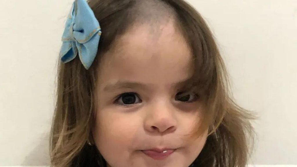 Menina De 2 Anos Raspa Cabelo Escondida Dos Pais E Diverte Calva De Cria